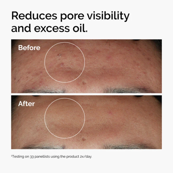 Niacinamide 10% + Zinc 1% - 60ml - Image 2